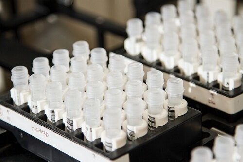 Chief lab officer and drug discovery search